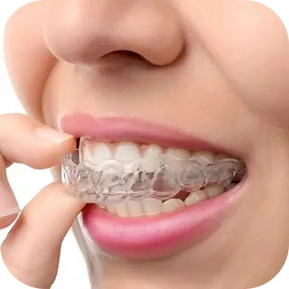 Teeth Straightening